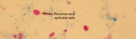 عکس سلول های پوششی