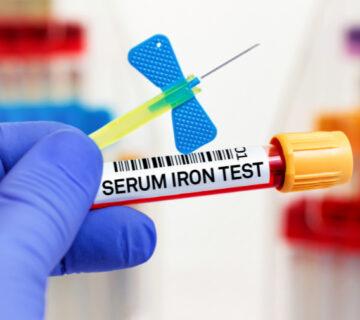 آزمایش آهن خون