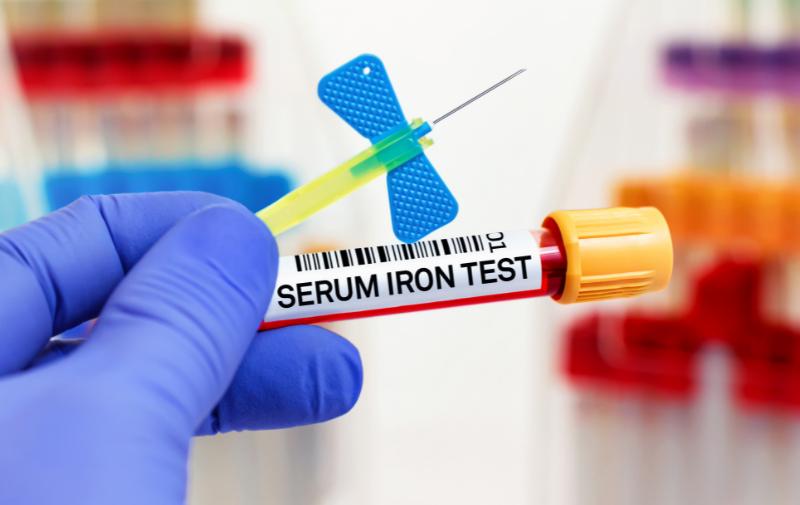 آزمایش آهن خون
