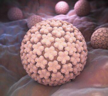 نوع 18 HPV
