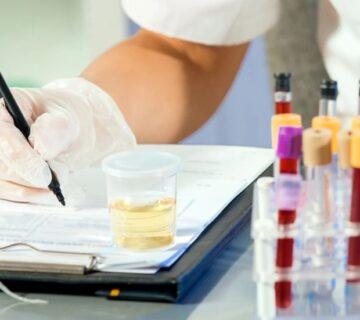 آزمایش الکتروفورز پروتئین