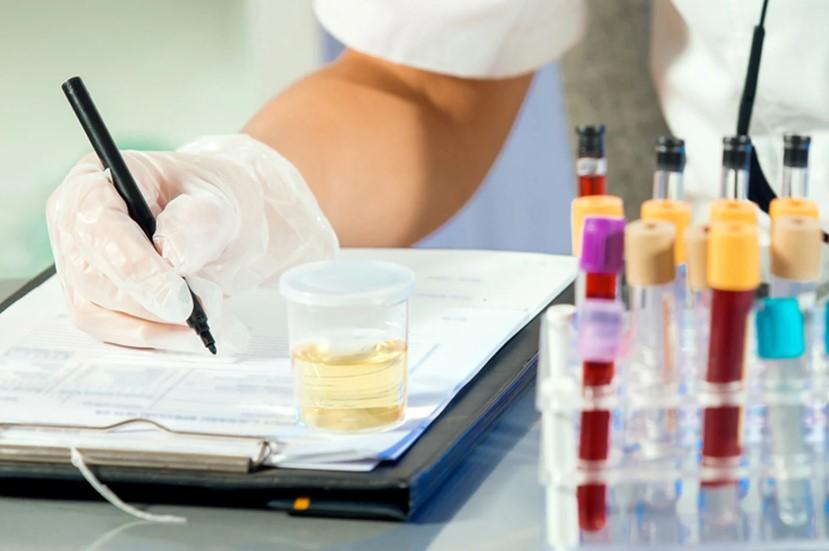 آزمایش الکتروفورز پروتئین