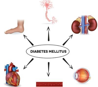 دیابت ملیتوس
