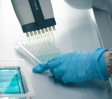 آزمایش الایزا