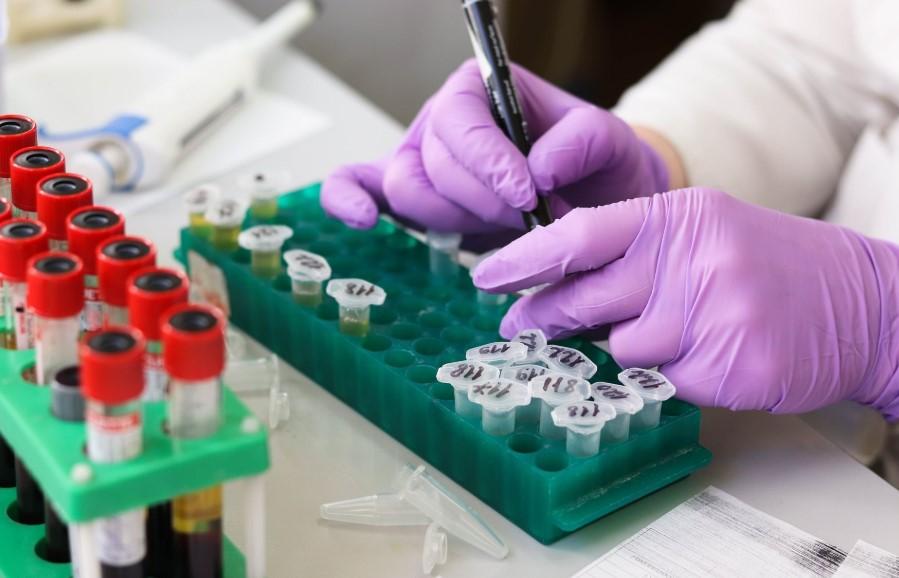 آزمایش‌های ایمونولوژیک