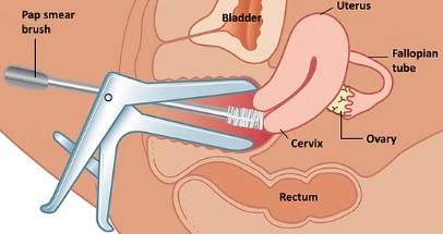 عکس نحوه پاپ اسمیر دختران
