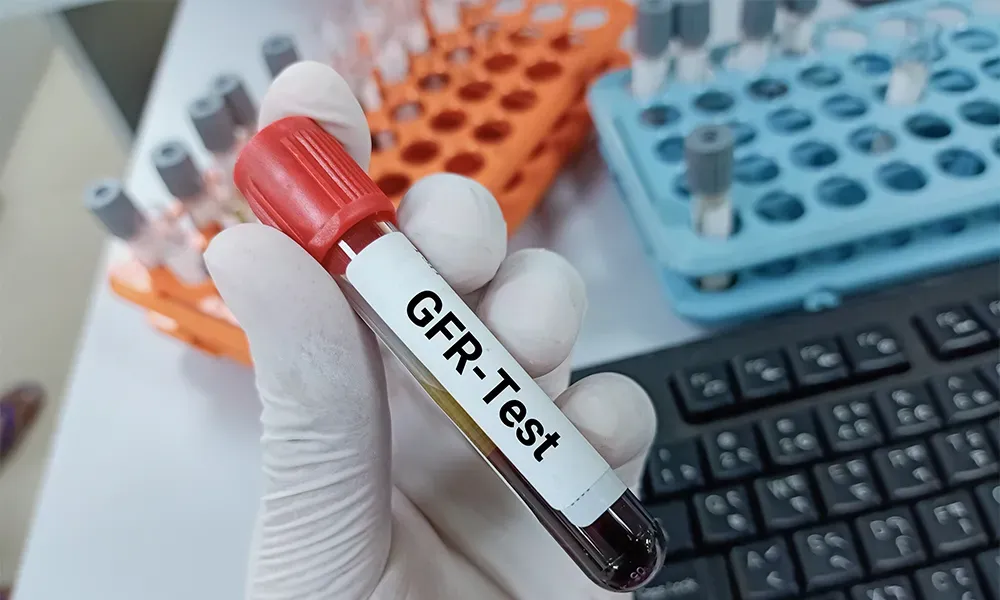 آزمایش GFR