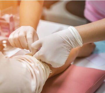 آزمایش خون کودک یک ساله