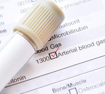 آزمایش گازهای خون شریانی