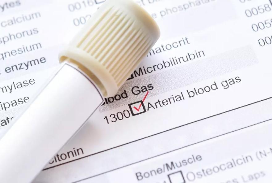 آزمایش گازهای خون شریانی