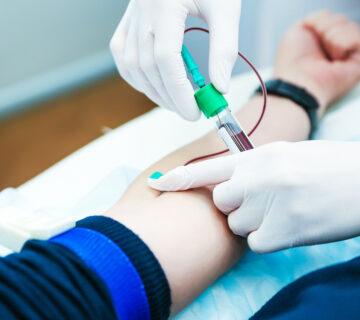 سرطان خون با آزمایش CBC