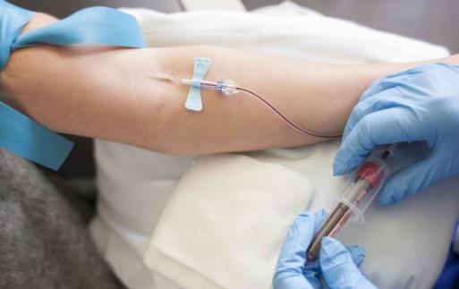 عکس آزمایش ABG