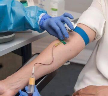 آزمایش وریدی و شریانی