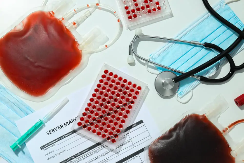 آزمایشات روتین قبل از عمل جراحی