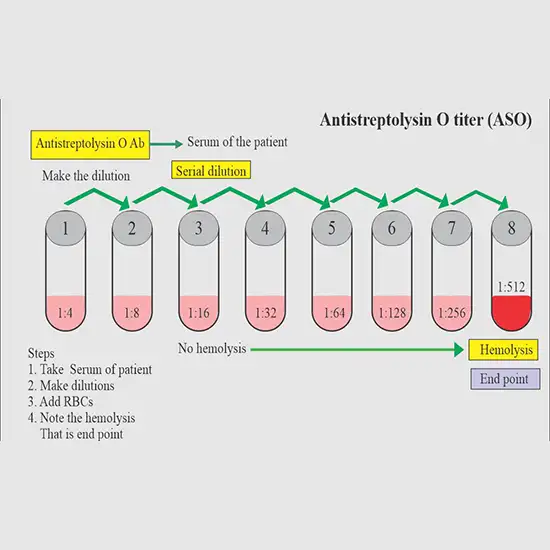 Anti Streptolysin O (ASO) Titre