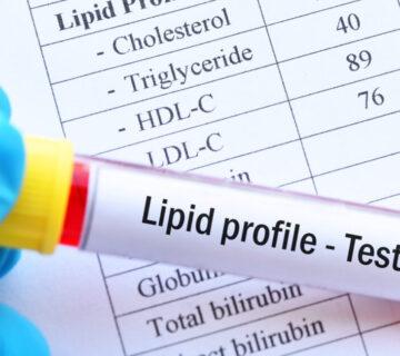 آزمایش چربی خون
