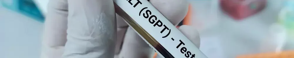 تست های عملکرد کبد SGOT و SGPT