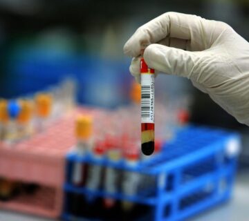 آلکالین فسفاتاز