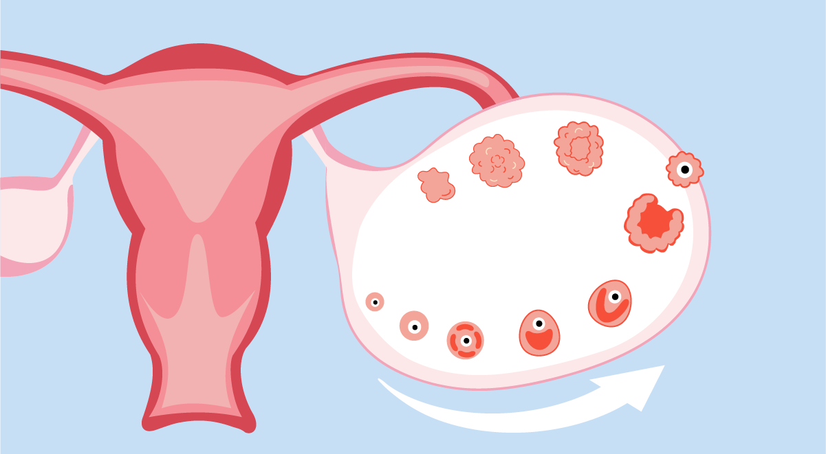 FSH در یائسگی زودرس