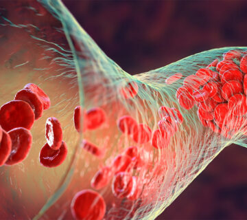 آزمایش زمان انعقاد خون