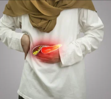 آزمایش سنگ کیسه صفرا