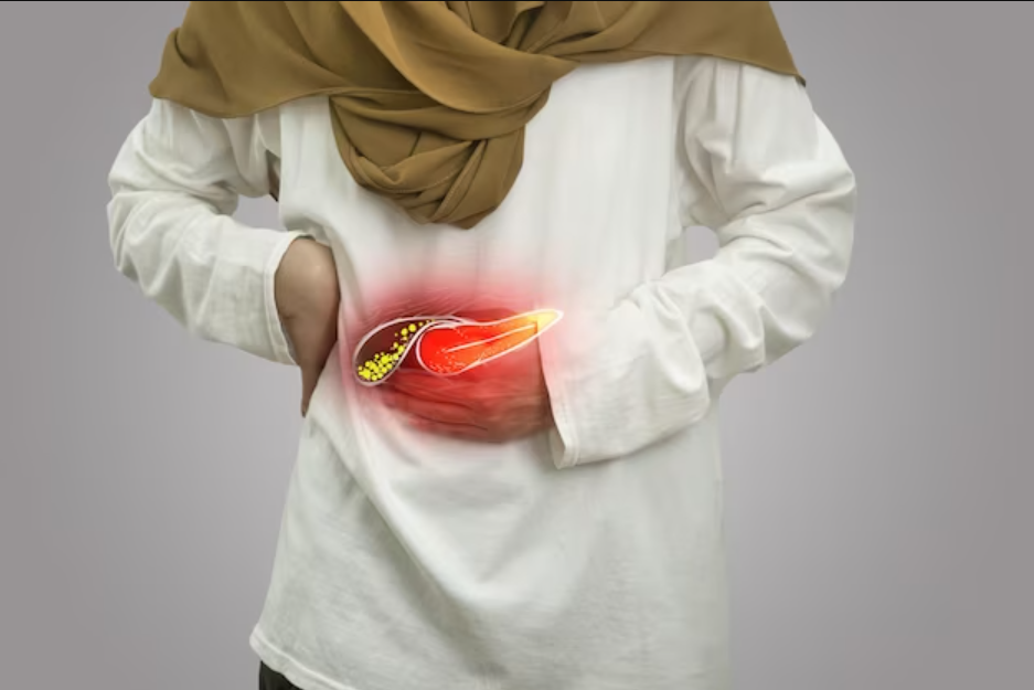 آزمایش سنگ کیسه صفرا