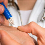 بیماری لایم