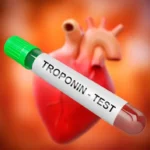 آزمایش تروپونین Troponin