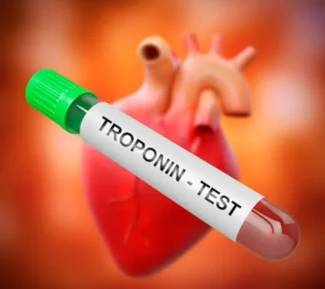 آزمایش تروپونین Troponin