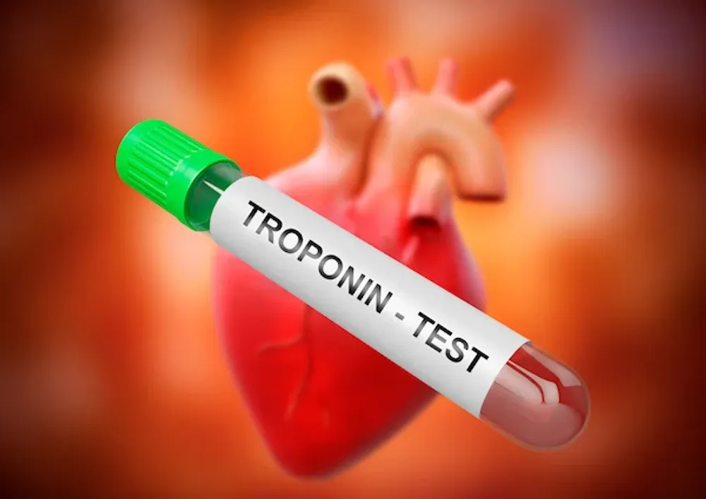 آزمایش تروپونین Troponin