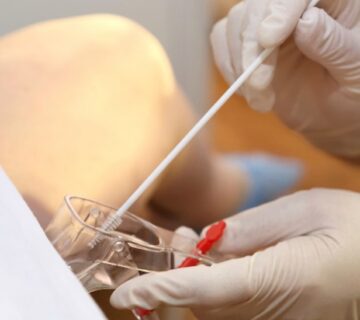 نوع کم خطر و پر خطر HPV