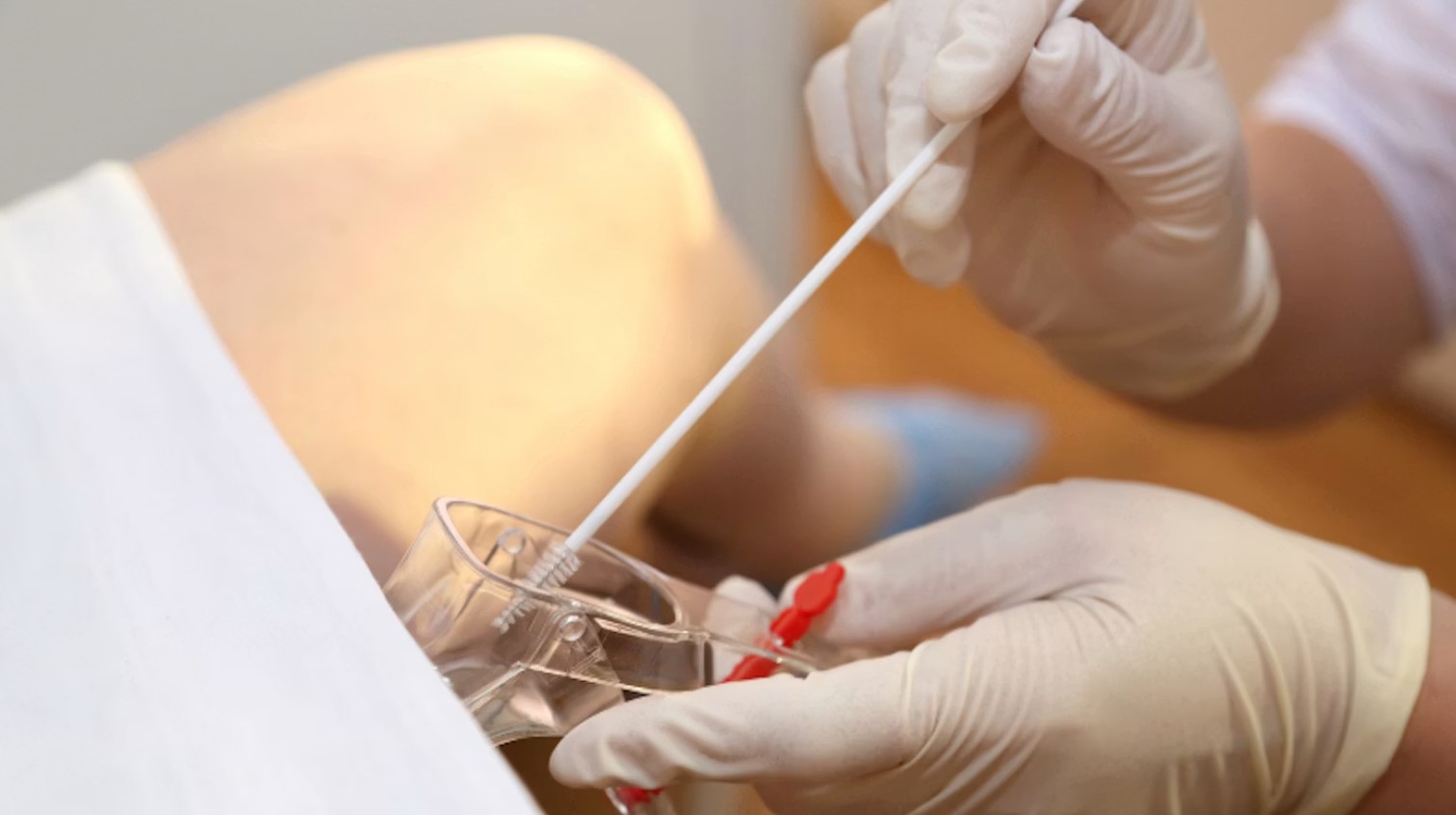 نوع کم خطر و پر خطر HPV