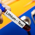آزمایش لیتیوم خون
